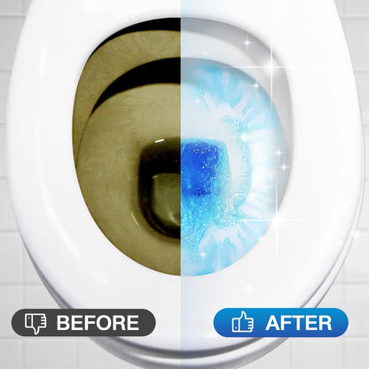 Vacplus Toilet Bowl Cleaners - 20 Pack Long-Lasting Toilet Cleaner Tablets, Prevent Stains & Deodorize, Blue & Pink