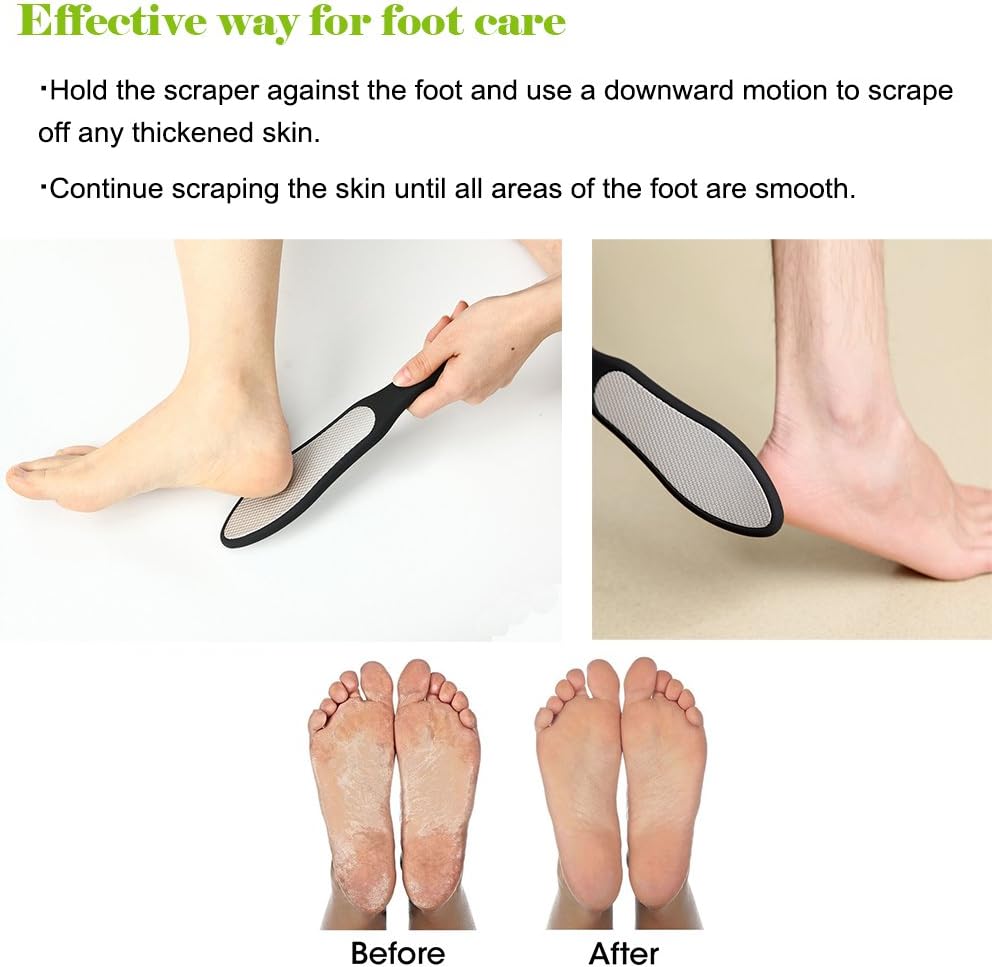 BEZOX Foot File Callus Remover, Double Sided Foot Scrubber for Dead Skin, Stainless Steel Pedicure File for Cracked Heel W/Cloth Storage Bag & Gift Box