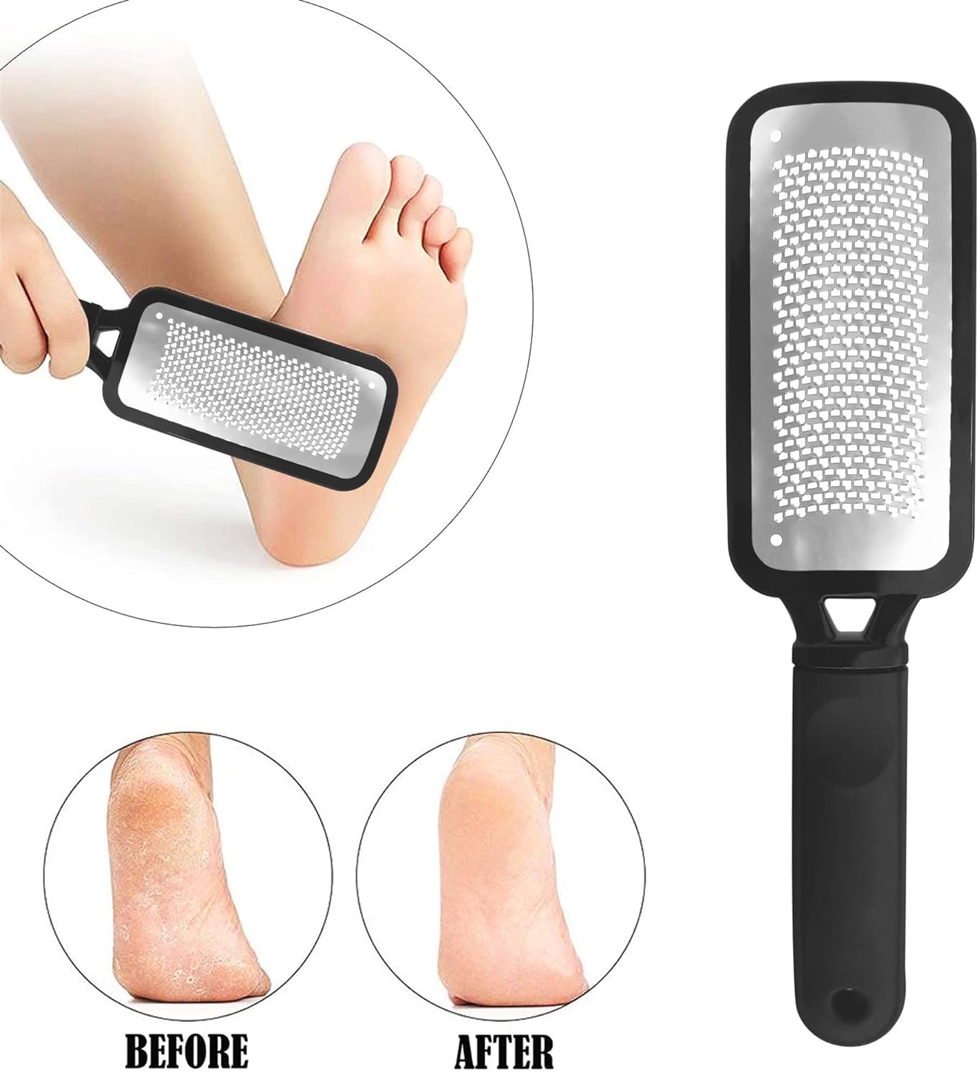 Professional Foot Files Callus Remover,Foot Scrubber for Dead Skin,Stainless Steel Foot Rasp-Pink（1 Pack）