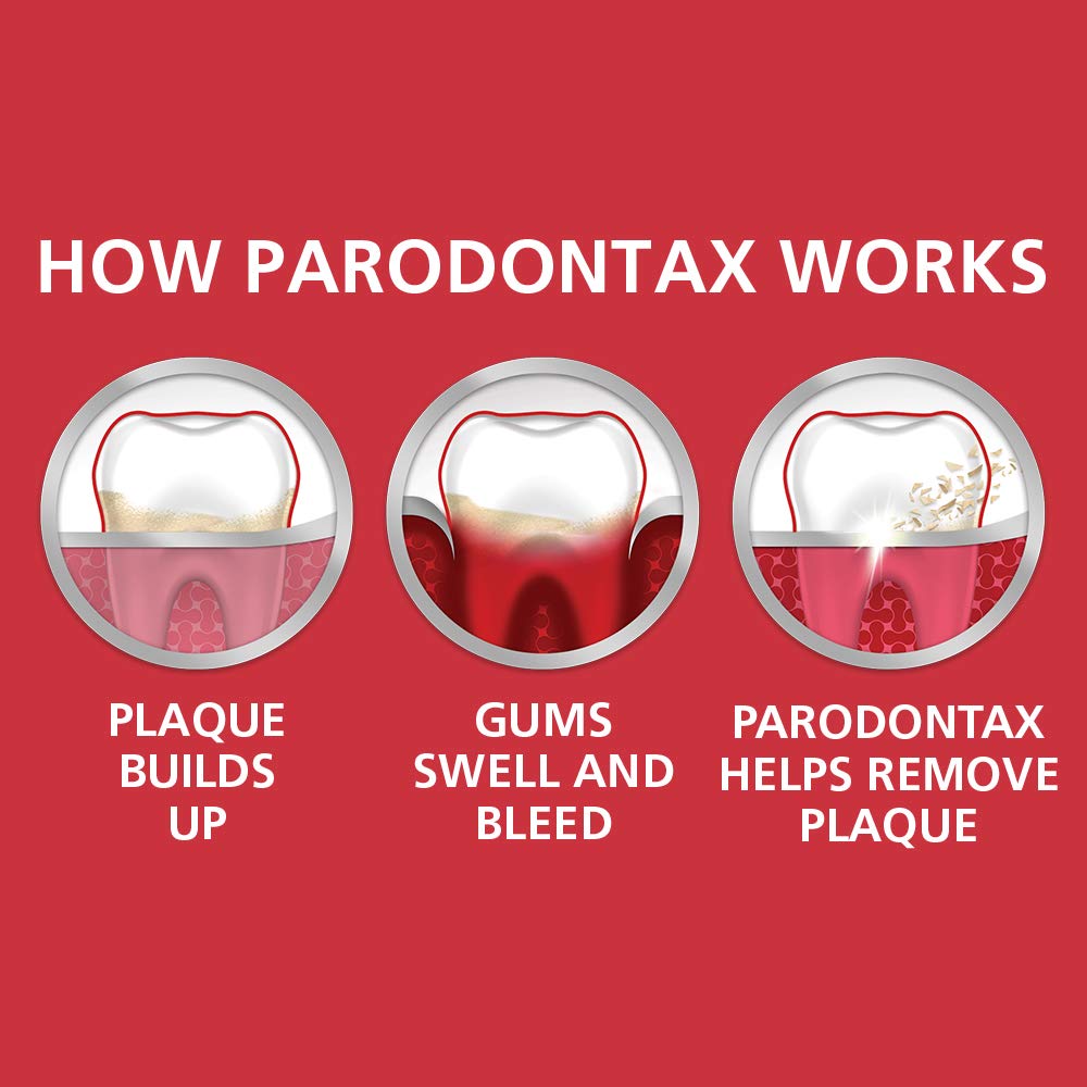 Parodontax Toothpaste for Bleeding Gums, Gingivitis Treatment and Cavity Prevention, Clean mint - 3.4 Ounces