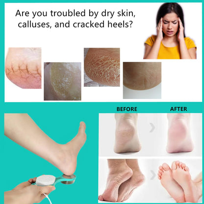 Foot File Callus Remover 5-in-1, 2 Pcs Feet Scraper Pedicure Tools with Pumice Stone, Scrubber Brush, Stainless Steel Foot Rasp and Sand Paper Debris Catcher, Multi Purpose, Cyan