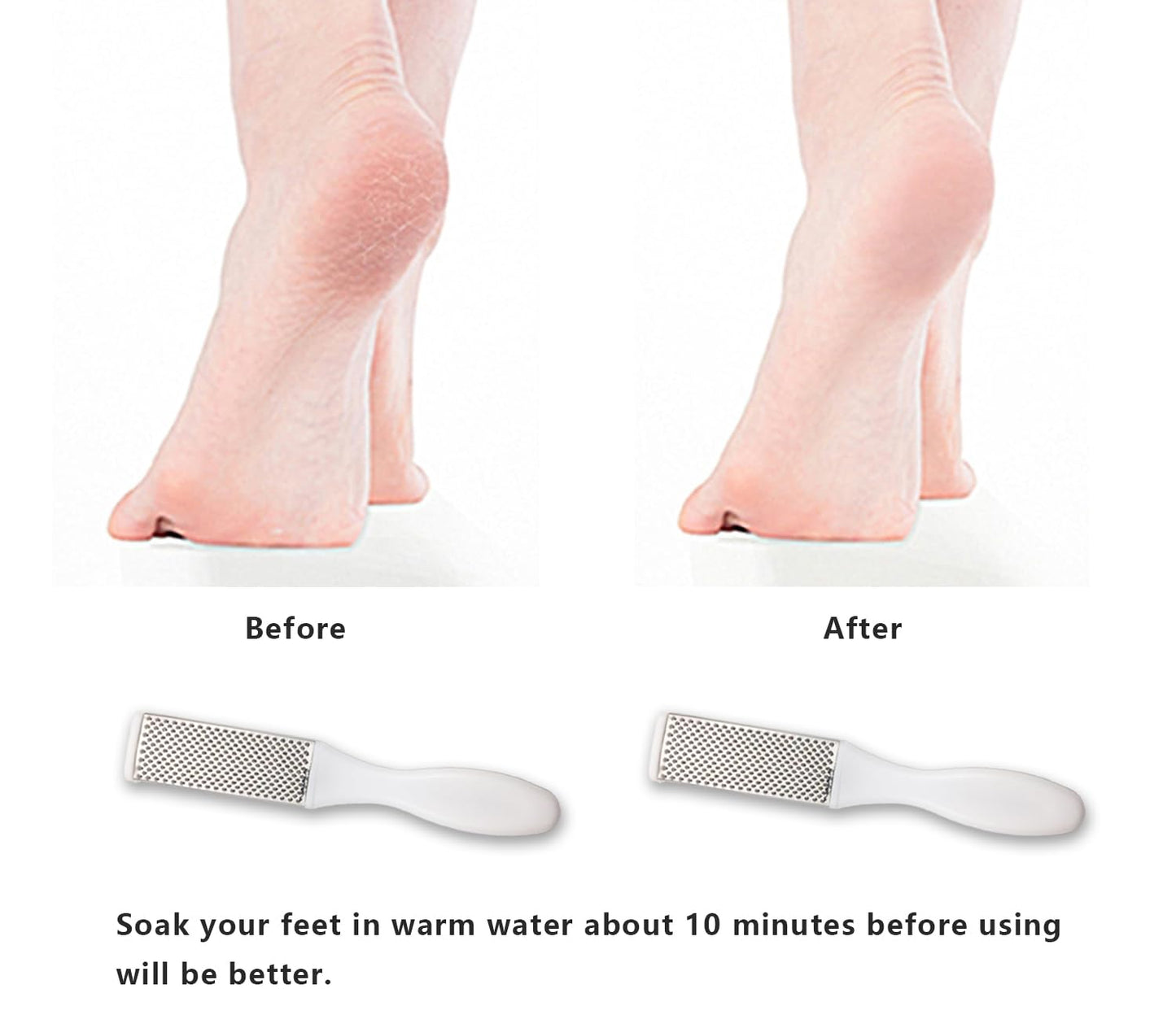 Professional Foot Files Callus Remover,Foot Scrubber for Dead Skin,Stainless Steel Foot Rasp-Pink（1 Pack）