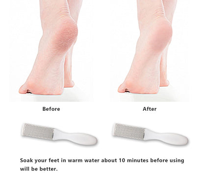 Professional Foot Files Callus Remover,Foot Scrubber for Dead Skin,Stainless Steel Foot Rasp-Pink（1 Pack）