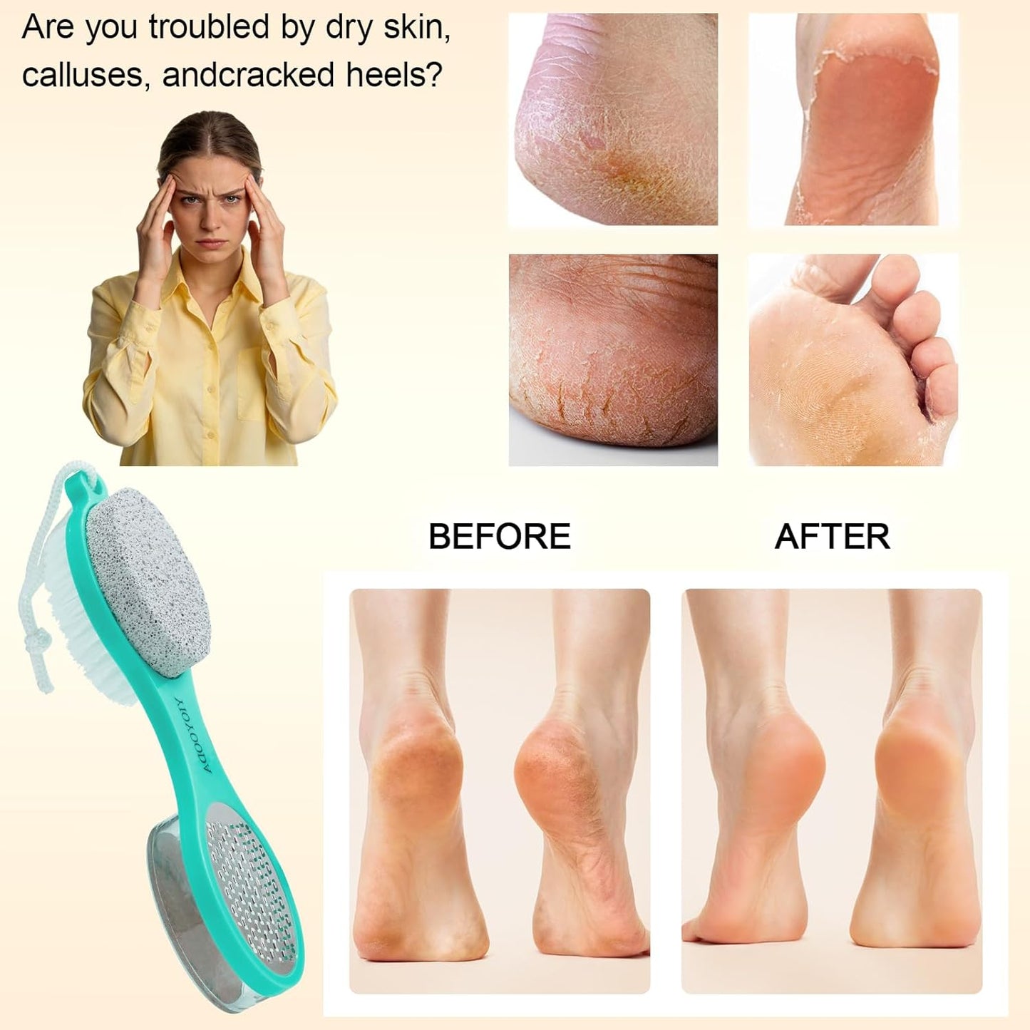 Foot File Callus Remover 5-in-1, 2 Pcs Feet Scraper Pedicure Tools with Pumice Stone, Scrubber Brush, Stainless Steel Foot Rasp and Sand Paper Debris Catcher, Multi Purpose, Cyan