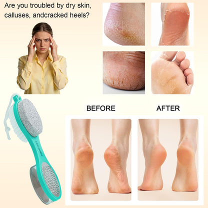 Foot File Callus Remover 5-in-1, 2 Pcs Feet Scraper Pedicure Tools with Pumice Stone, Scrubber Brush, Stainless Steel Foot Rasp and Sand Paper Debris Catcher, Multi Purpose, Cyan