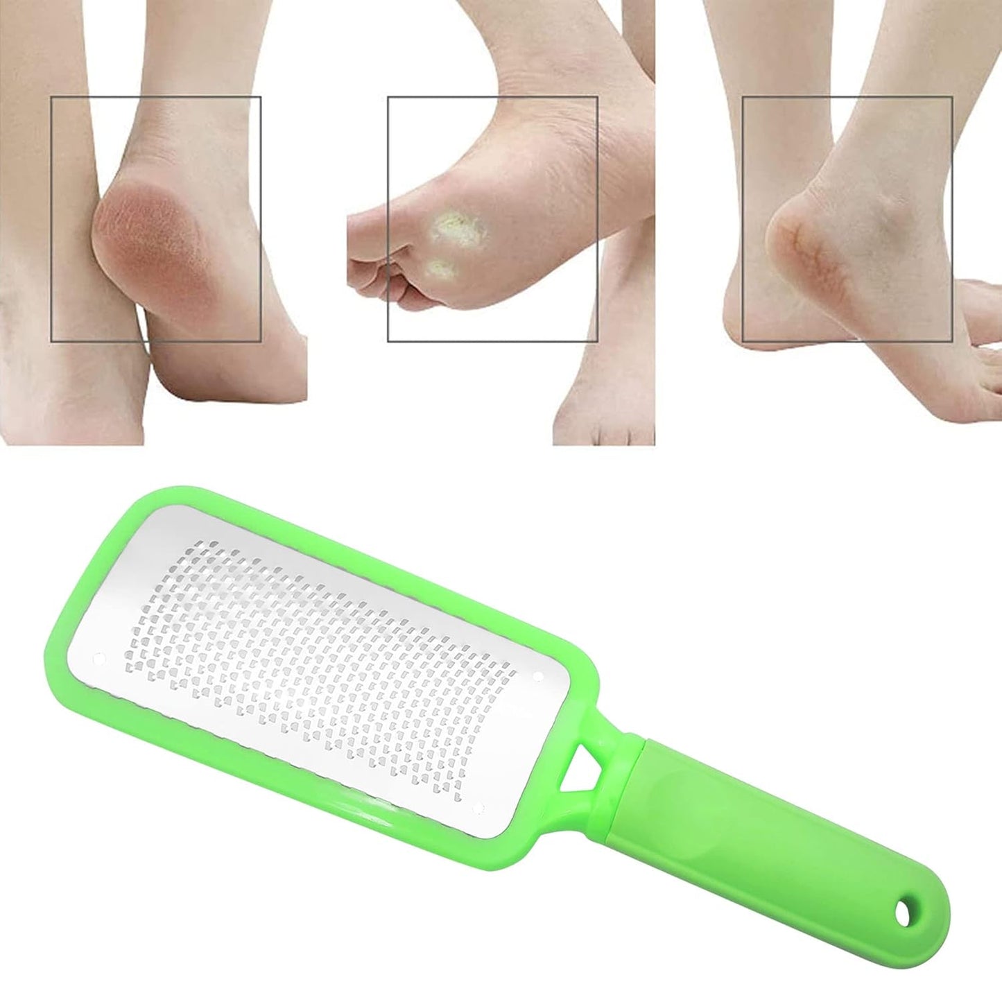 Professional Foot Files Callus Remover,Foot Scrubber for Dead Skin,Stainless Steel Foot Rasp-Pink（1 Pack）