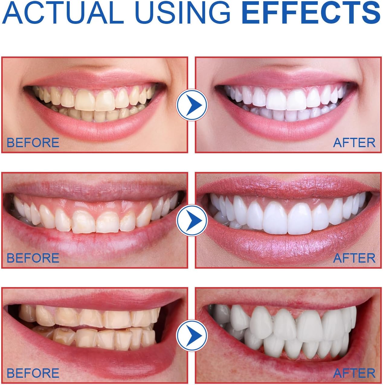 2PCS SP-6 Toothpaste, SP6 Probiotic Toothpaste, Fresh Breath, Deep Cleaning Care