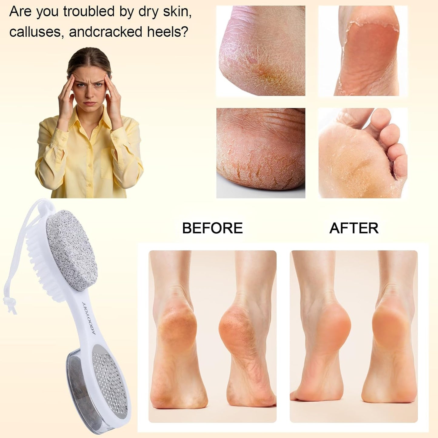 Foot File Callus Remover 5-in-1, 2 Pcs Feet Scraper Pedicure Tools with Pumice Stone, Scrubber Brush, Stainless Steel Foot Rasp and Sand Paper Debris Catcher, Multi Purpose, Cyan