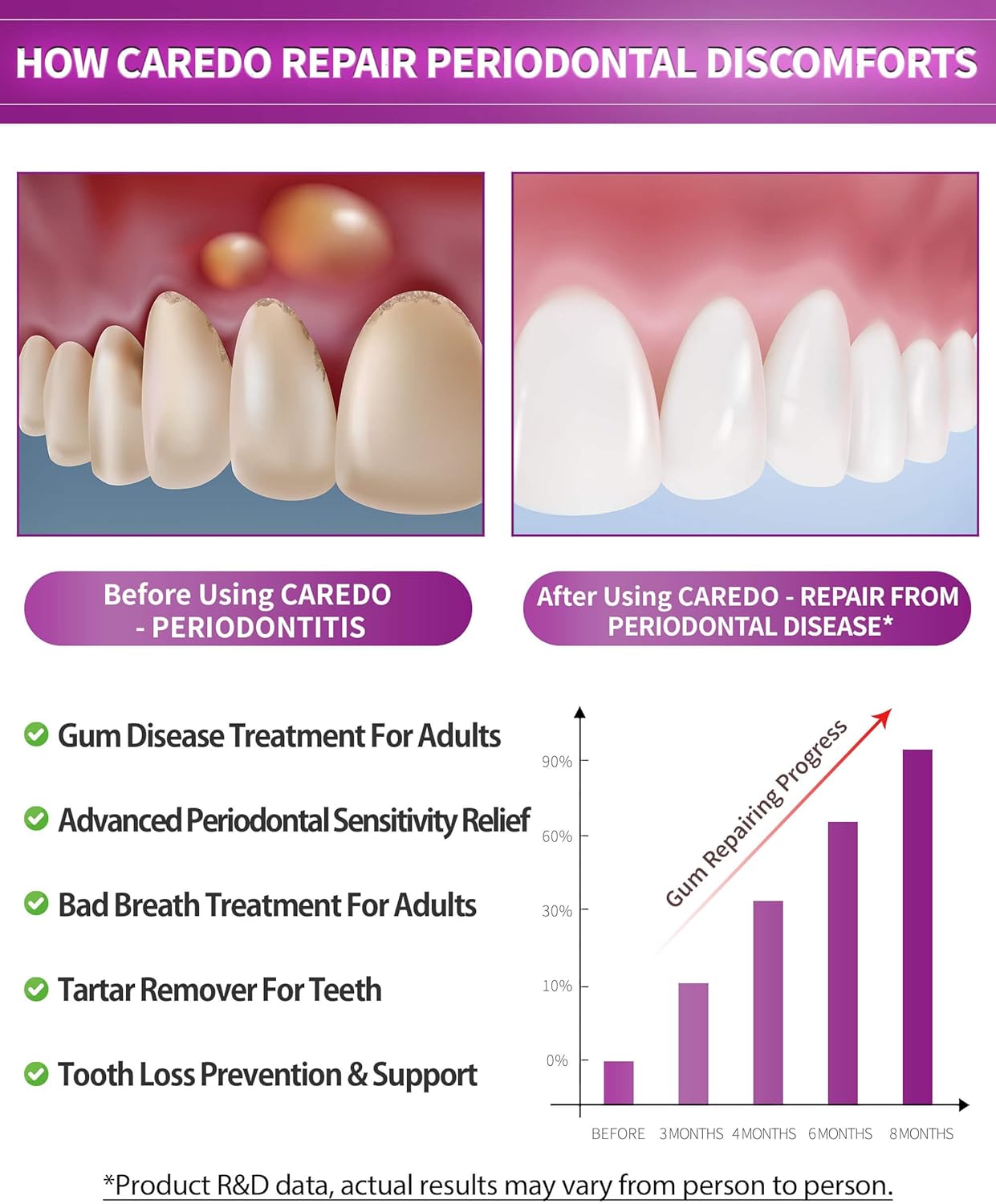CAREDO Gum Toothpaste for Periodontitis, Gum Repair for Receding Gums, Gum Disease & Gingivitis Treatment, Periodontal Disease Treatment for Gum Health, Gum Disease Repair Bad Breath Toothpaste 3.52OZ