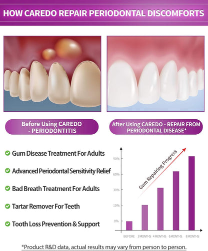 CAREDO Gum Toothpaste for Periodontitis, Gum Repair for Receding Gums, Gum Disease & Gingivitis Treatment, Periodontal Disease Treatment for Gum Health, Gum Disease Repair Bad Breath Toothpaste 3.52OZ