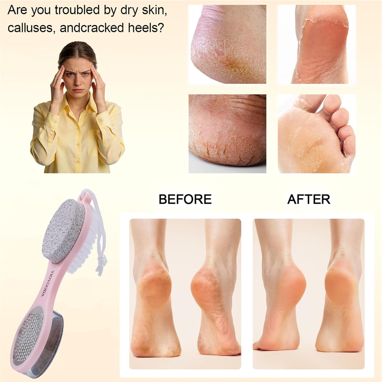 Foot File Callus Remover 5-in-1, 2 Pcs Feet Scraper Pedicure Tools with Pumice Stone, Scrubber Brush, Stainless Steel Foot Rasp and Sand Paper Debris Catcher, Multi Purpose, Cyan
