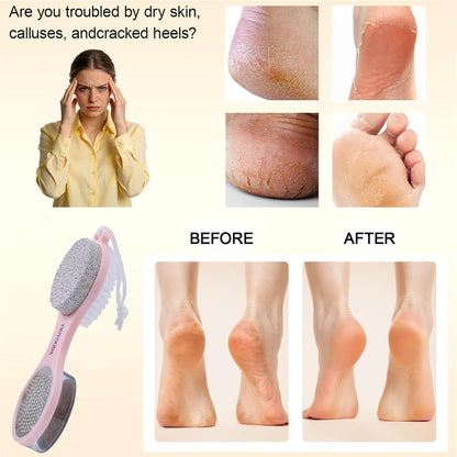 Foot File Callus Remover 5-in-1, 2 Pcs Feet Scraper Pedicure Tools with Pumice Stone, Scrubber Brush, Stainless Steel Foot Rasp and Sand Paper Debris Catcher, Multi Purpose, Cyan