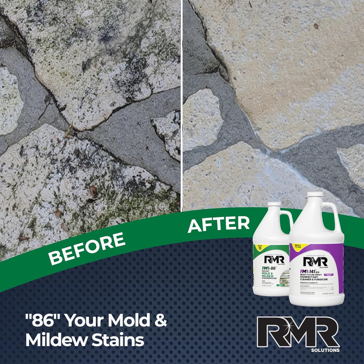 RMR Brands DIY Mold & Stain Remover Bundle, Complete Mold Killer & Mildew Prevention Kit, Disinfectant Spray, Includes 2-32 fluid ounce Bottles